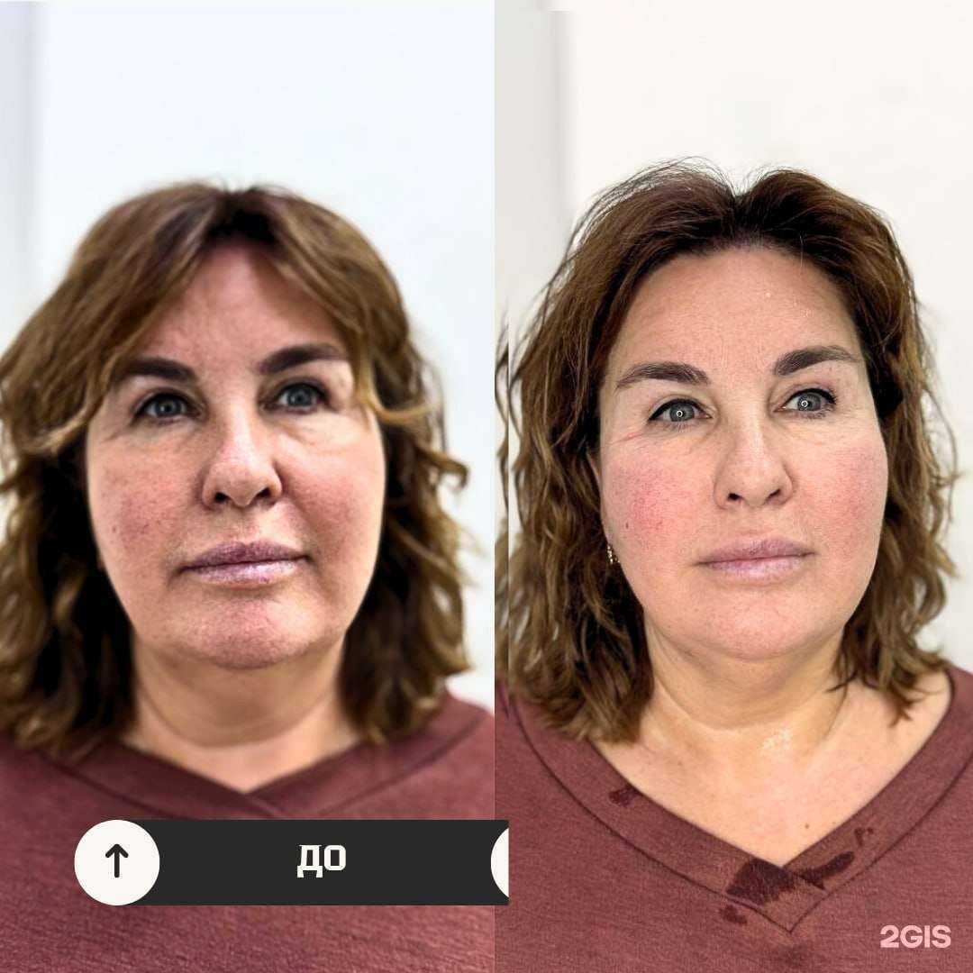 Отзывы на компанию Лицо и тело в Краснодаре c фото