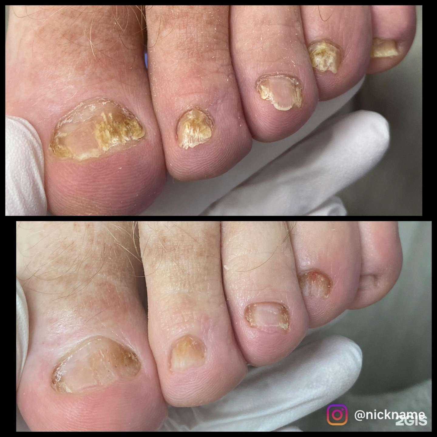 Отзывы на компанию Здоровые стопы в Новокузнецке c фото