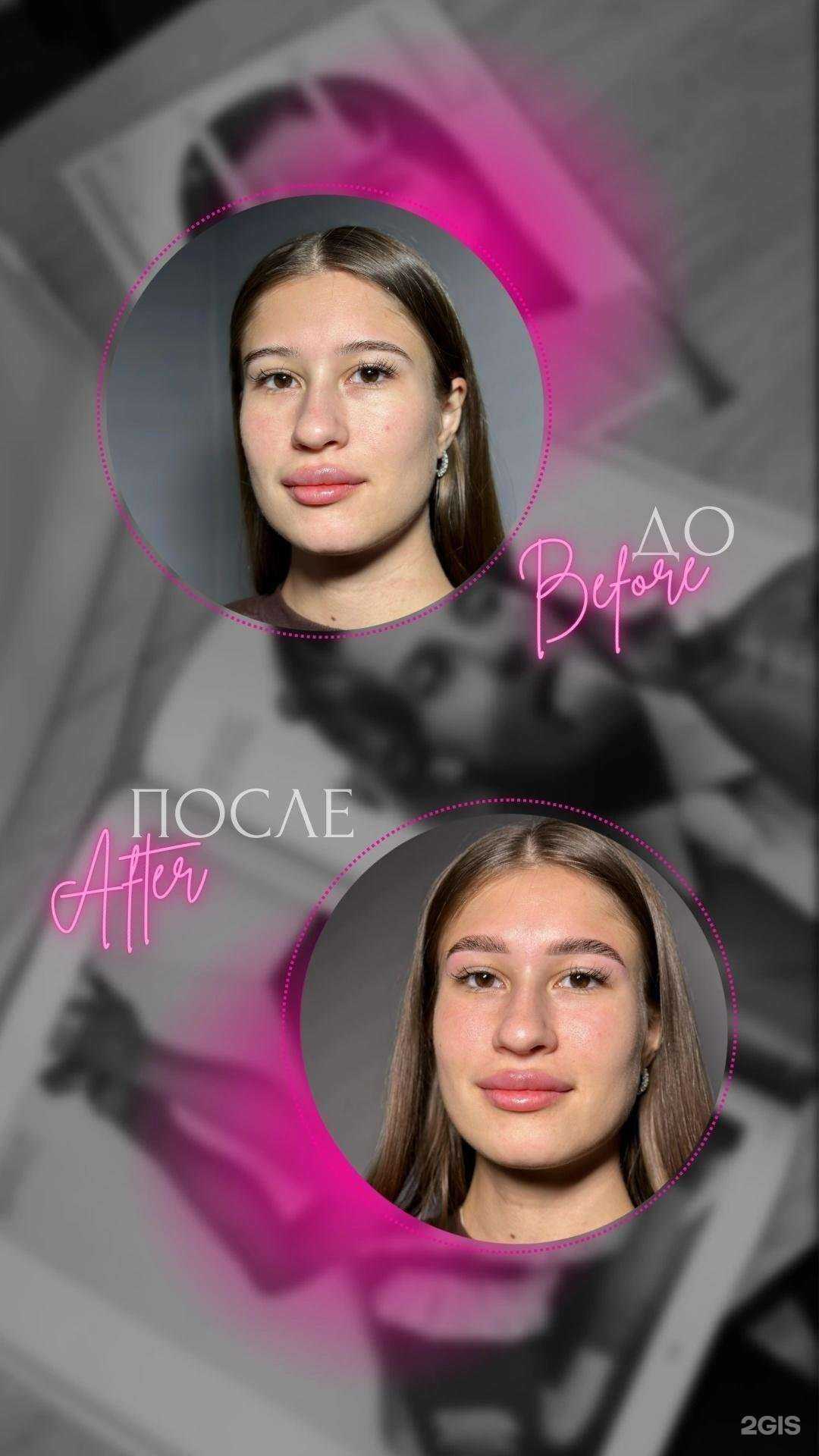 Отзывы на компанию Lar_depil.khv в Хабаровске c фото