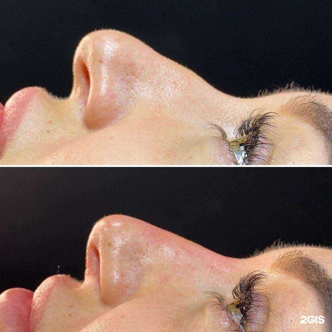 Отзывы на компанию Beauty Face в Краснодаре c фото