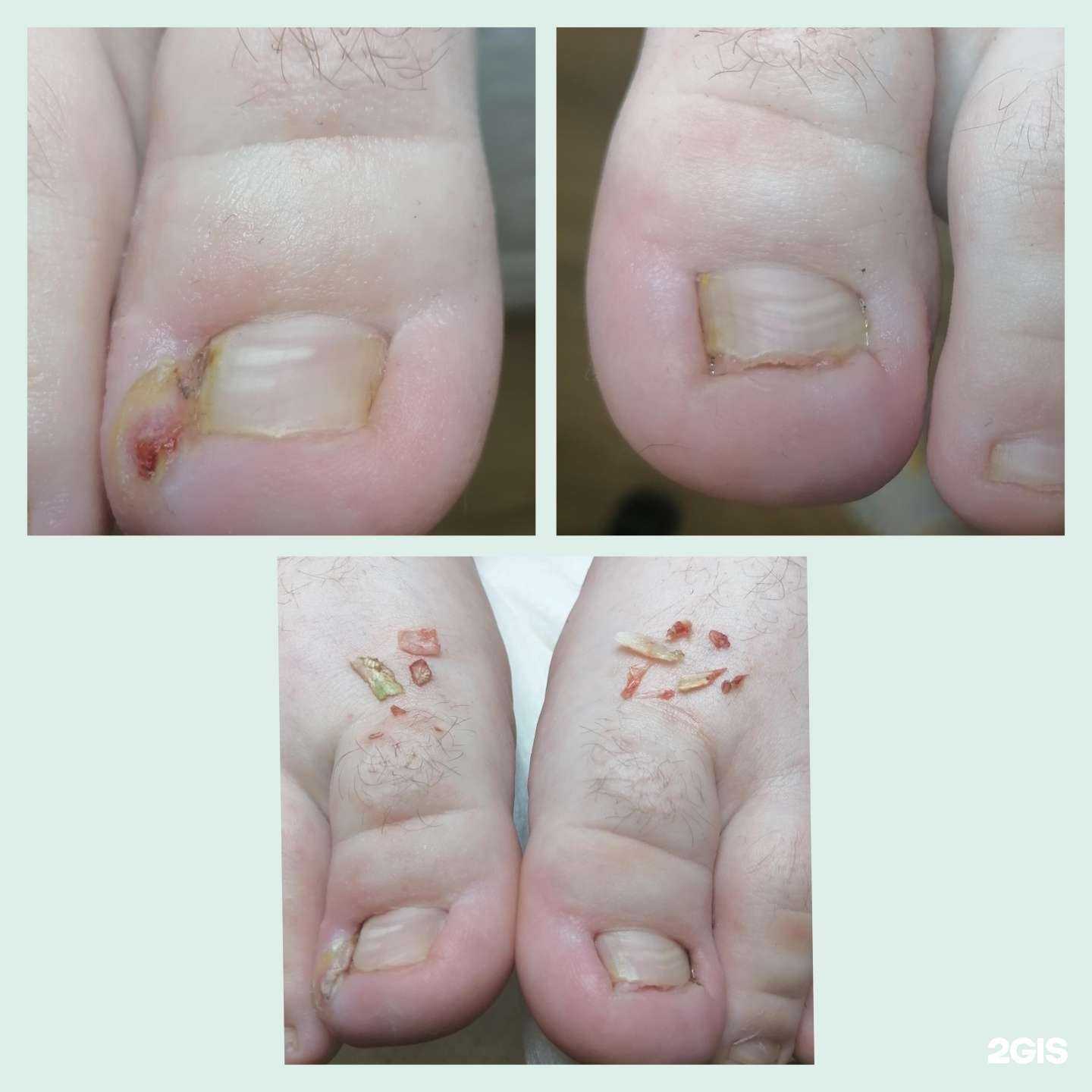 Отзывы на компанию Podo pedicure в Краснодаре c фото