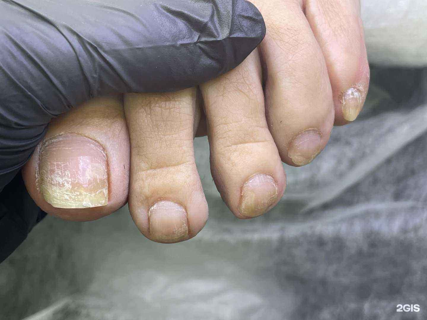 Отзывы на компанию Кабинет подологии ног и педикюра в г. Сургут c фото