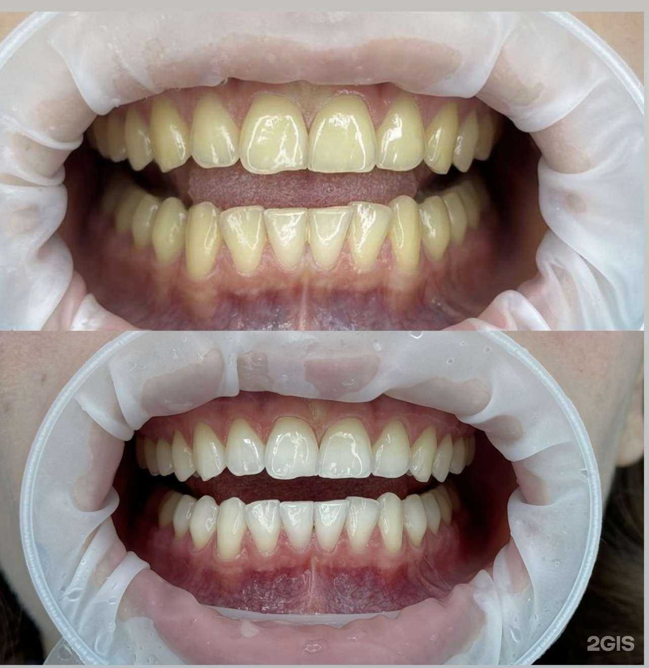 Отзывы на компанию White&smile в Кемерове c фото