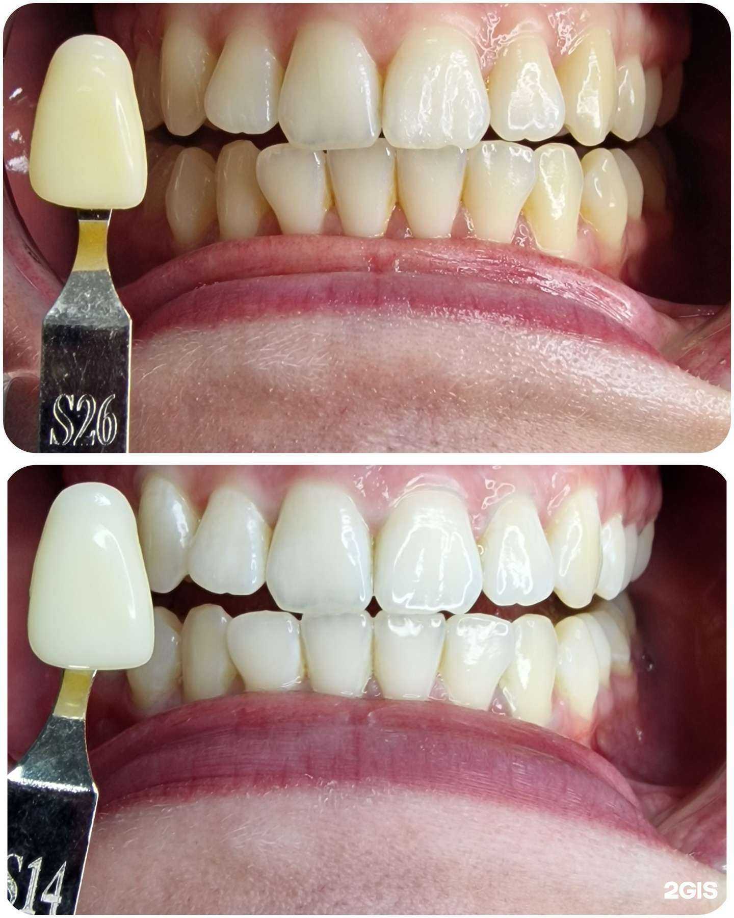 Отзывы на компанию Your brilliant smile в Казани c фото