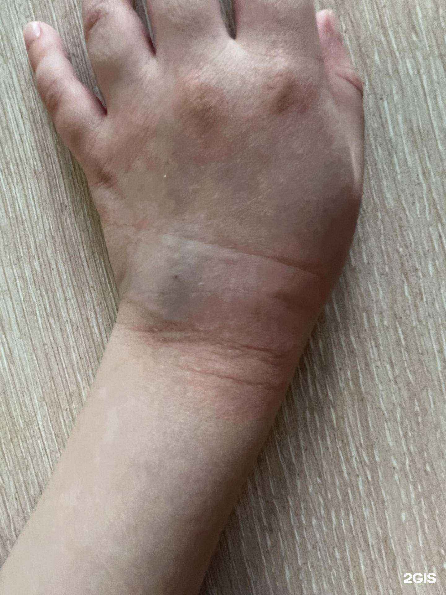 Отзывы на компанию Invitro в Краснодаре c фото