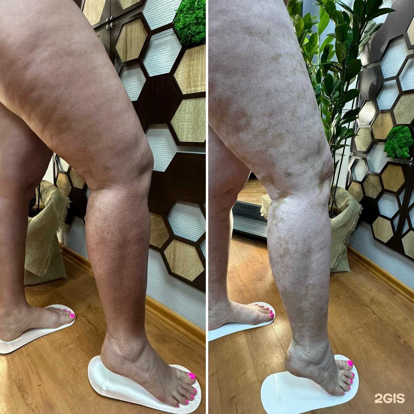 Отзывы на компанию Bogdanova zagar в г. Самара c фото