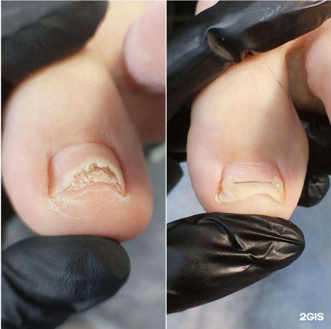 Отзывы на компанию Кабинет подолога в Сургуте c фото