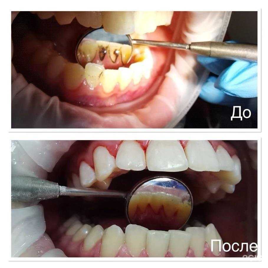 Отзывы на компанию Академия Дент в г. Ростов-на-Дону c фото