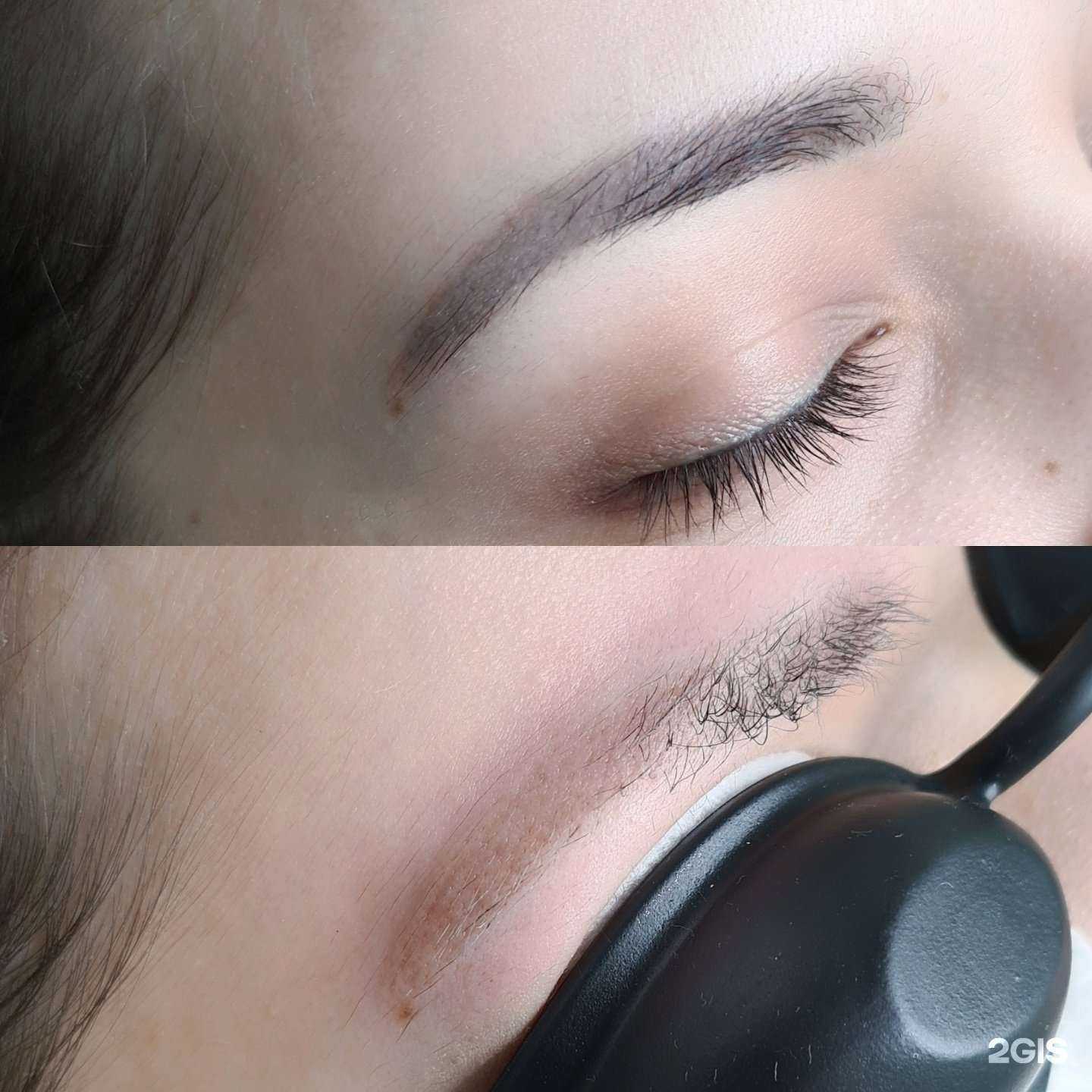 Отзывы на компанию Perfect cosmetology в г. Самара c фото