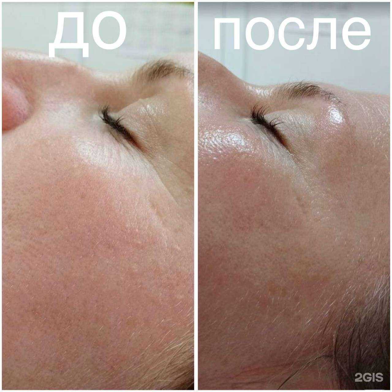 Отзывы на компанию Кабинет косметологии в г. Хабаровск c фото