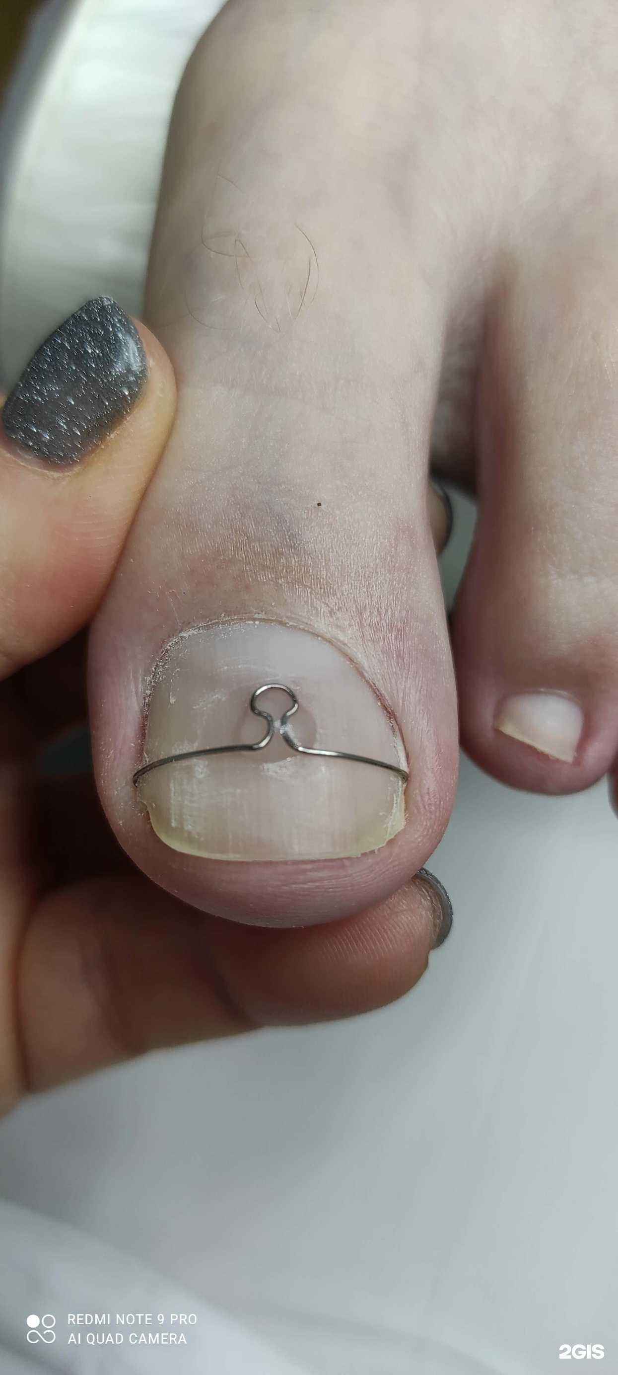 Отзывы на компанию PodoProfi в Петропавловске-Камчатском c фото