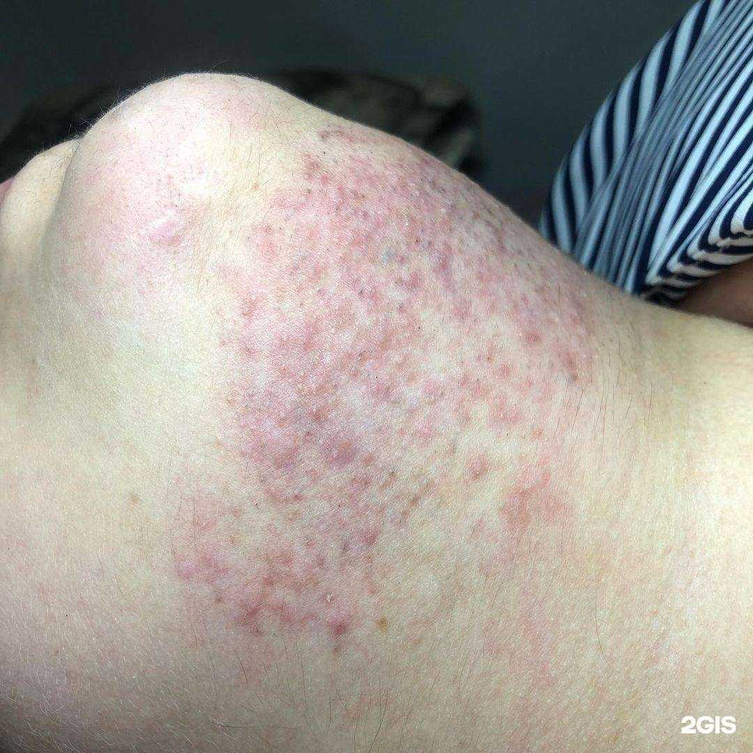 Отзывы на компанию Electroepil_mv в г. Минеральные Воды c фото