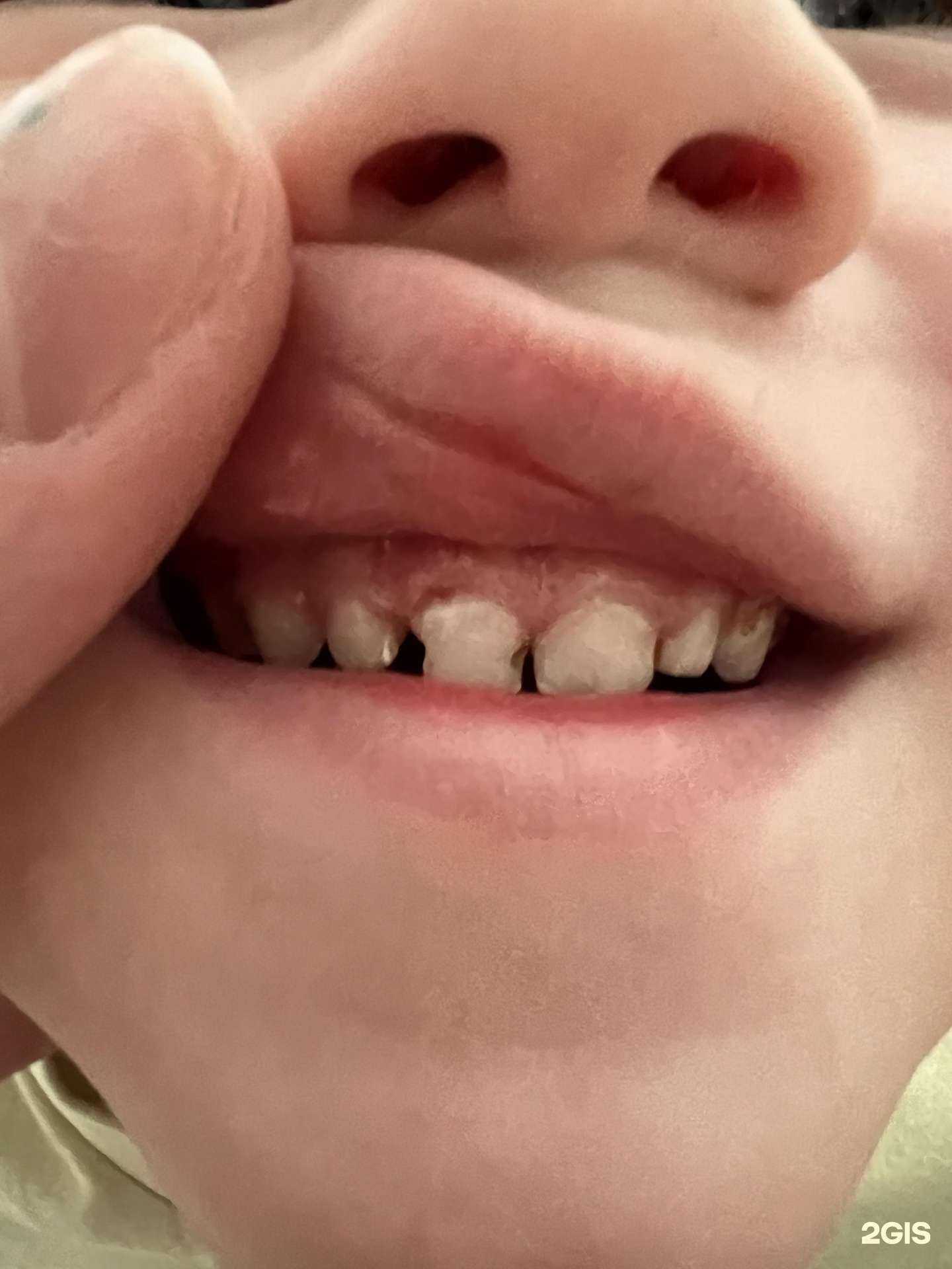 Отзывы на компанию МиДента в г. Кировск c фото