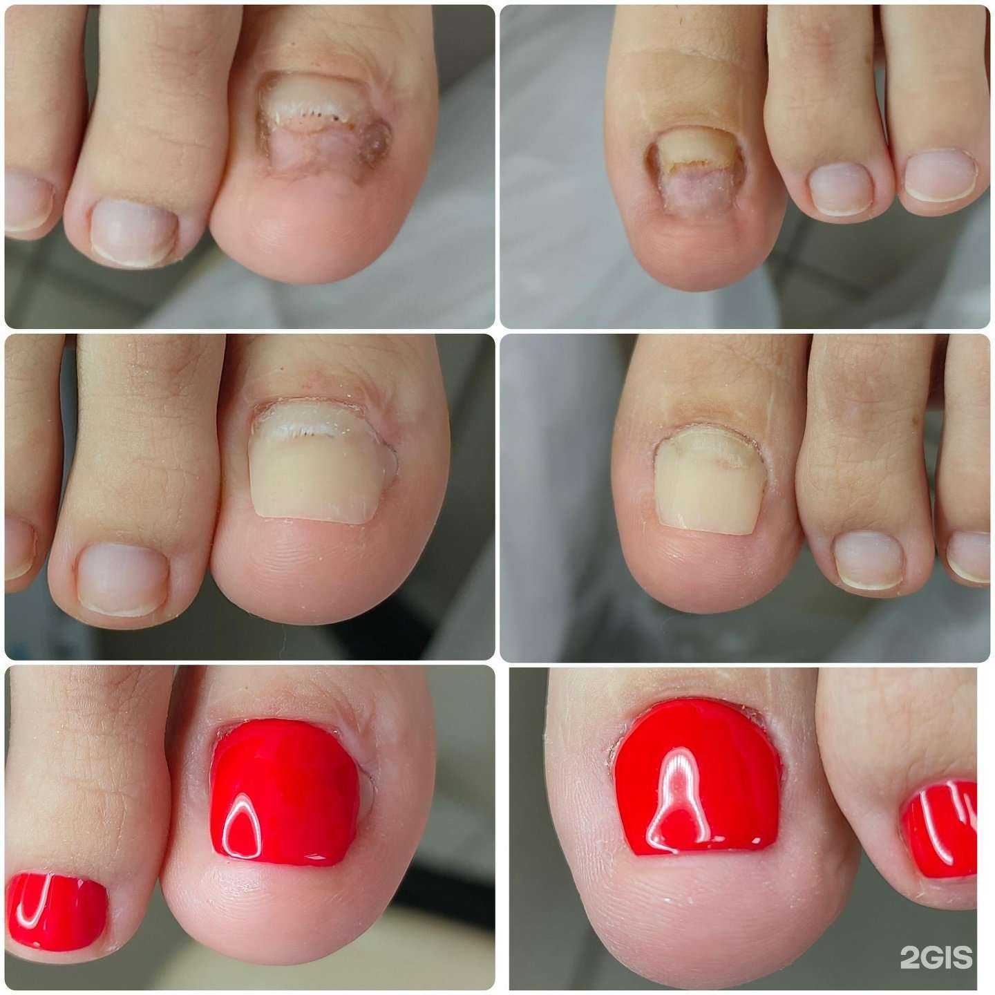 Отзывы на компанию Подолог Кедрина в Анапе c фото