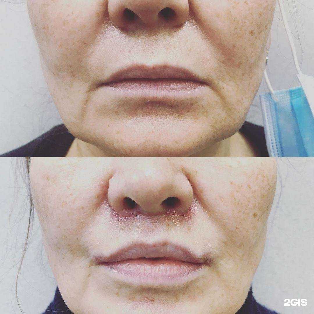 Отзывы на компанию Пластика в Перми c фото