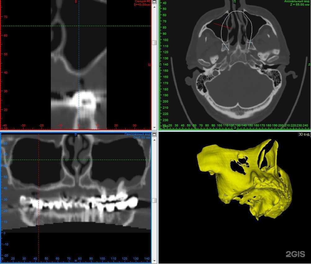 Отзывы на компанию Гладент в г. Липецк c фото