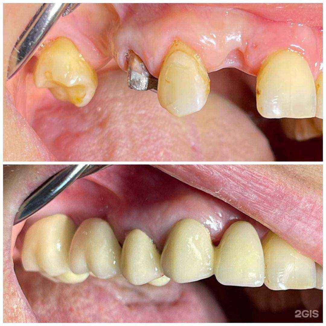 Отзывы на компанию Эстетик, стоматология в г. Маркс c фото