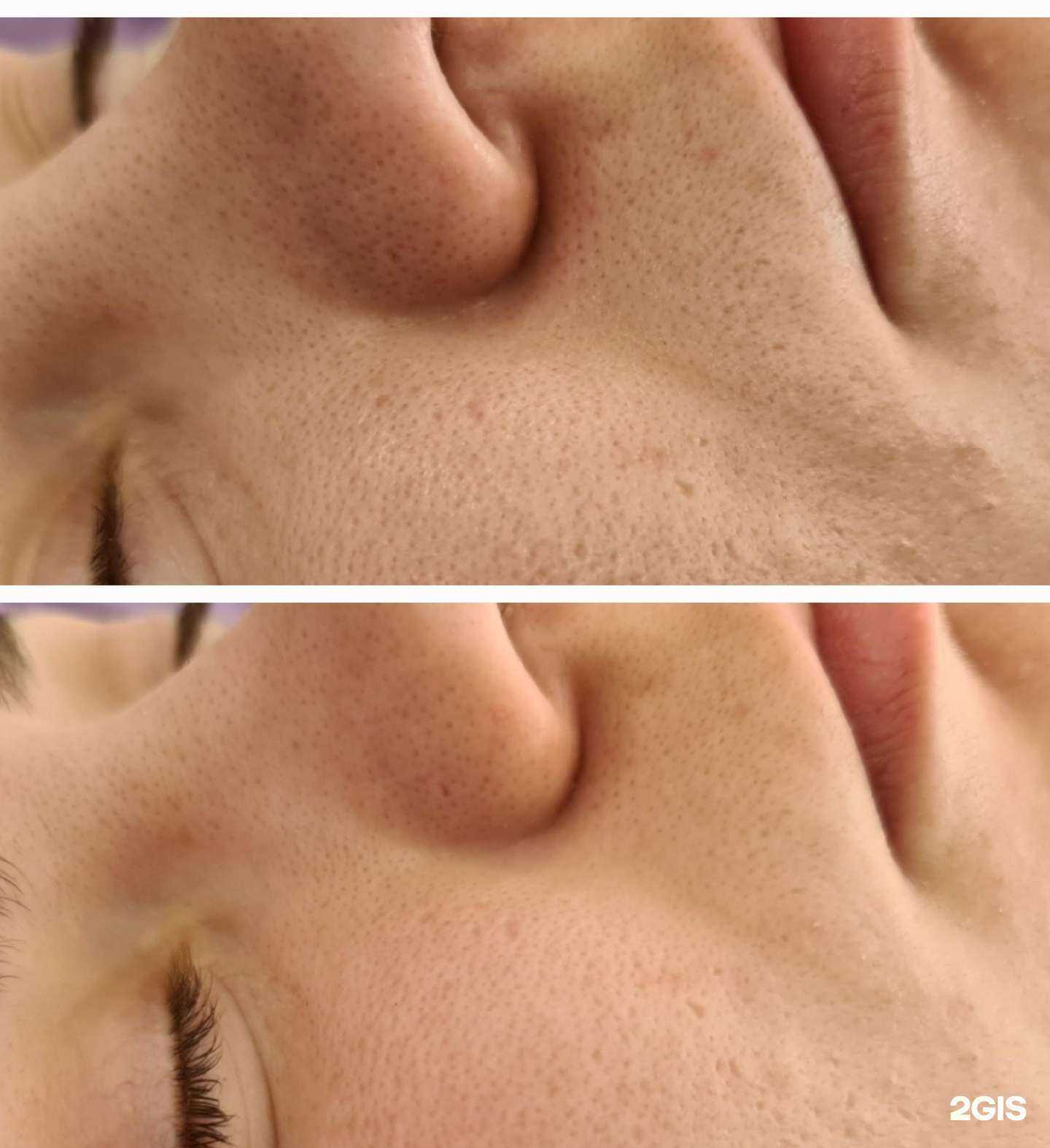 Отзывы на компанию Sweet epil_nsk в Новосибирске c фото