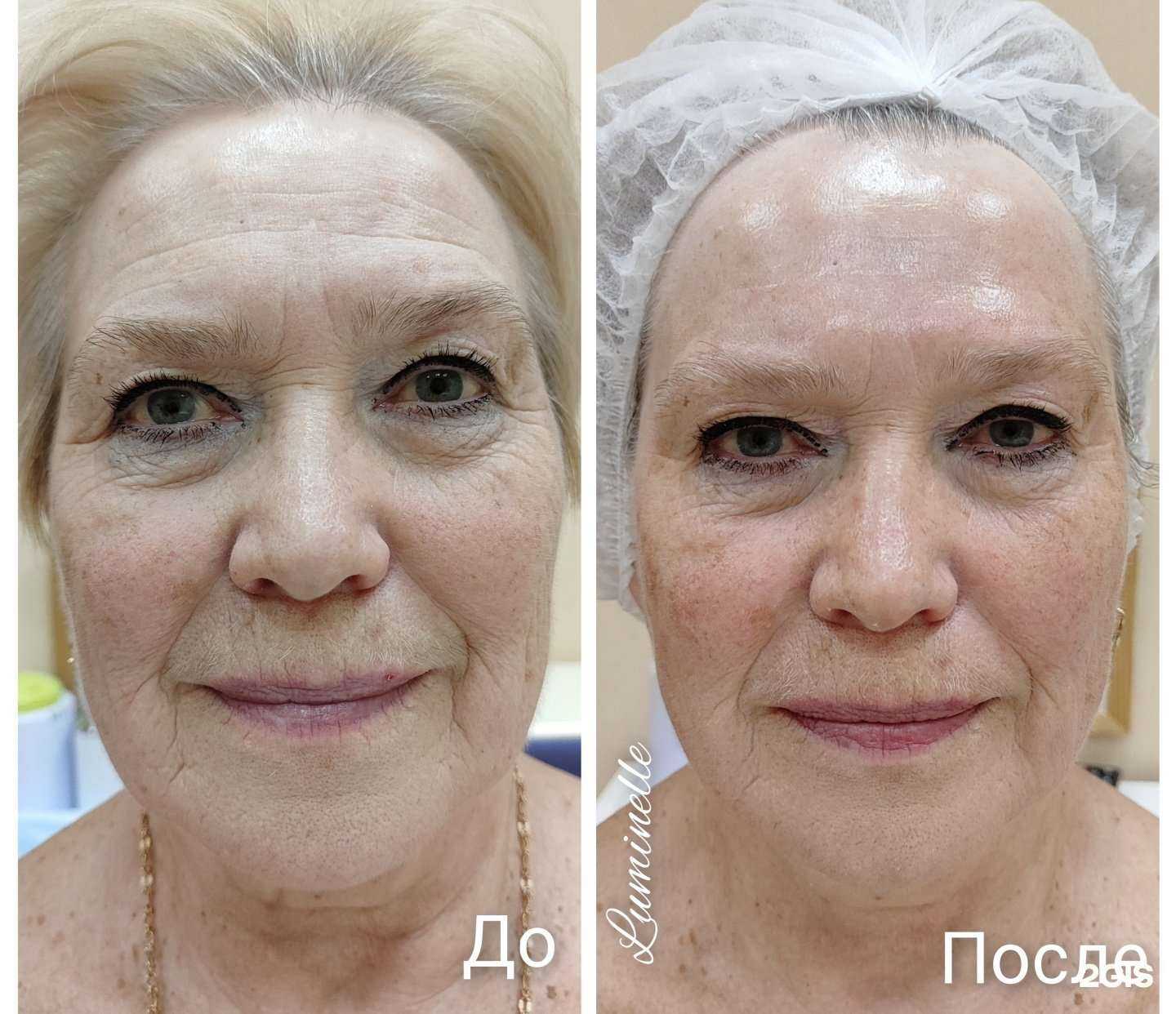 Отзывы на компанию Luminelle в г. Екатеринбург c фото