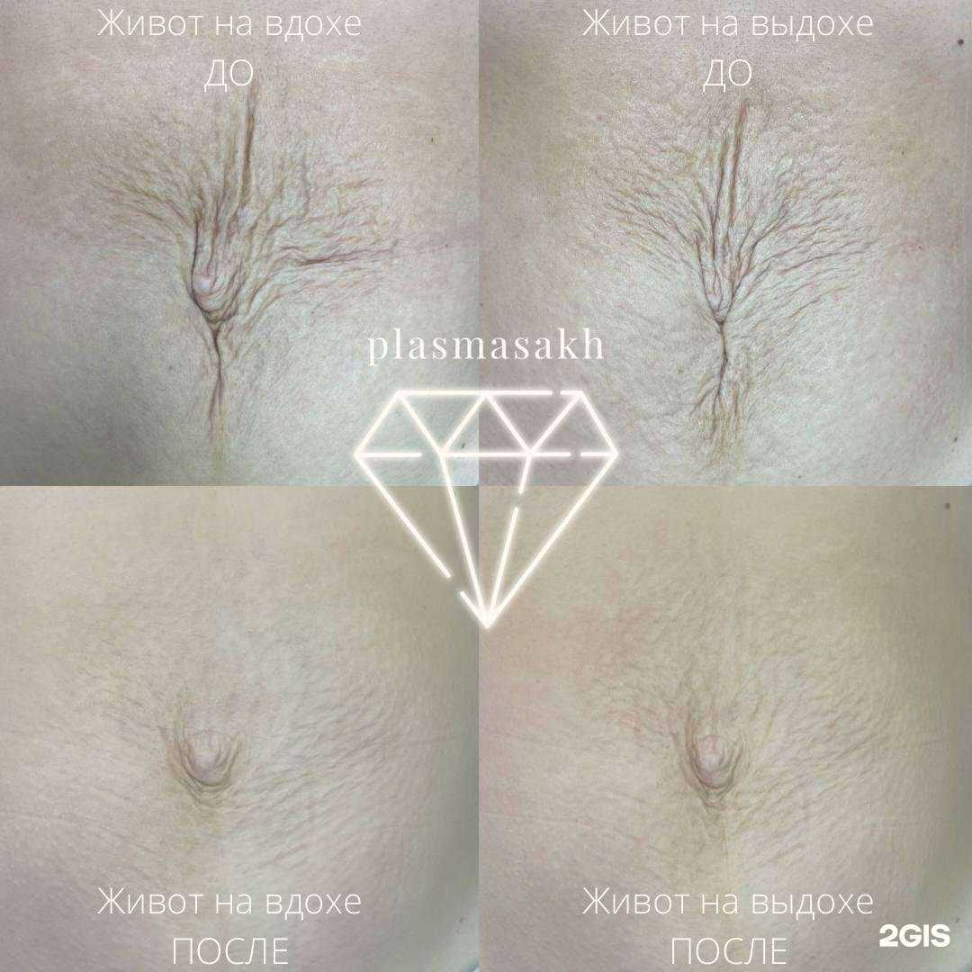 Отзывы на компанию Plasmasakh в г. Южно-Сахалинск c фото