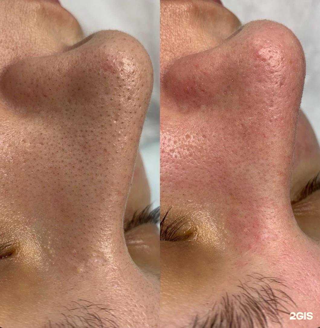 Отзывы на компанию KosMedLaser в г. Воронеж c фото