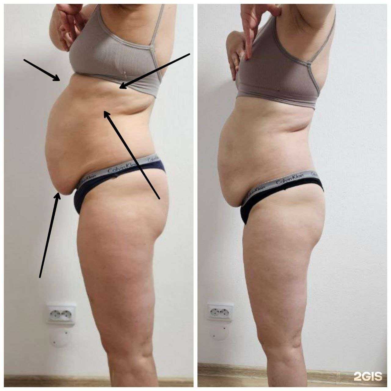 Отзывы на компанию Студия коррекции фигуры в Екатеринбурге c фото