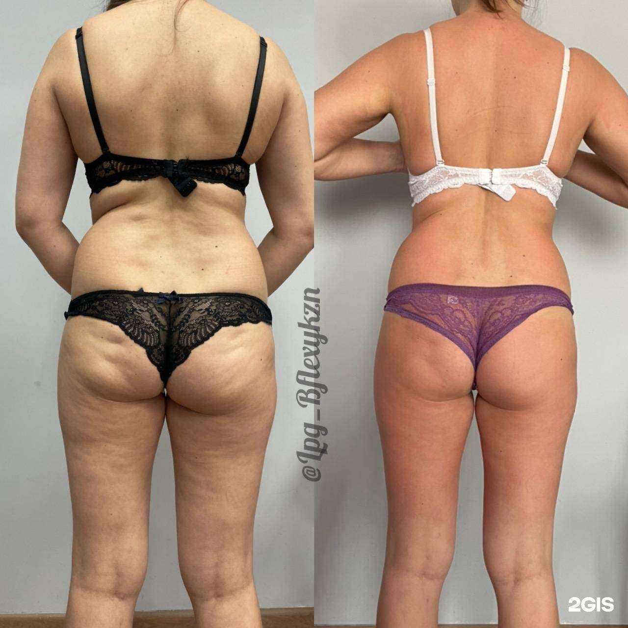 Отзывы на компанию B-flexy в Казани c фото