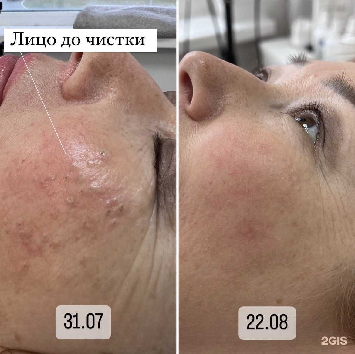 Отзывы на компанию Skinbar  в Сургуте c фото