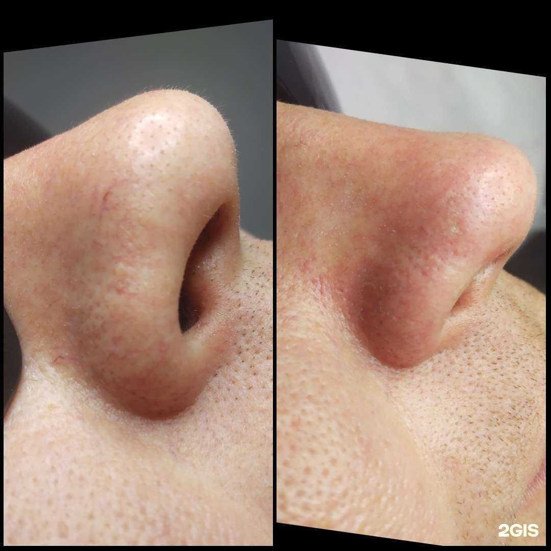 Отзывы на компанию Кабинет элос-эпиляции в Челябинске c фото