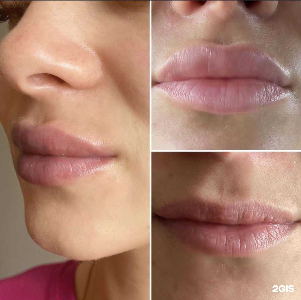 Отзывы на компанию Армин косметолог в Иркутске c фото