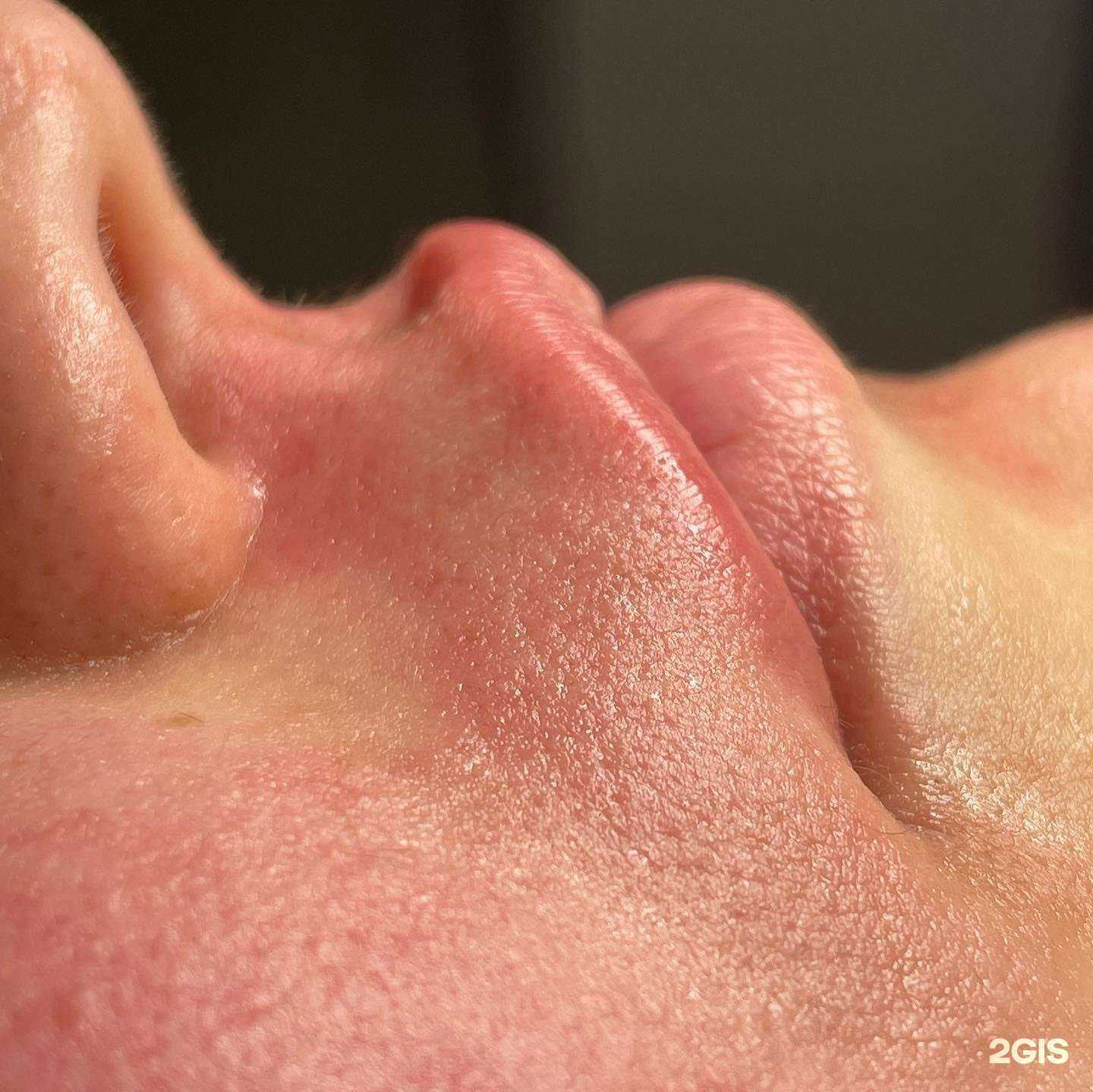 Отзывы на компанию ElectroEpil в Краснодаре c фото