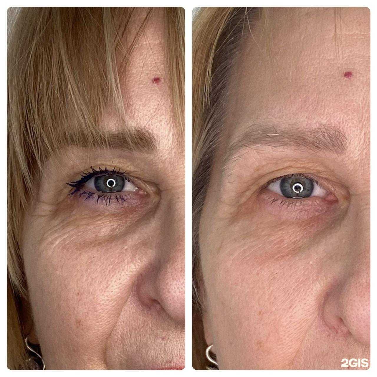 Отзывы на компанию Molodost’ в г. Тюмень c фото