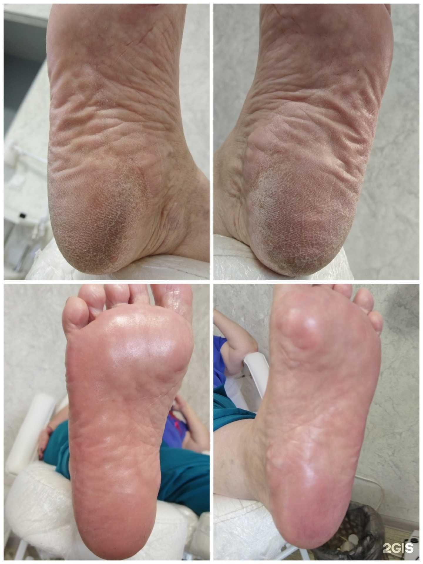 Отзывы на компанию Кабинет смарт-педикюра в Барнауле c фото