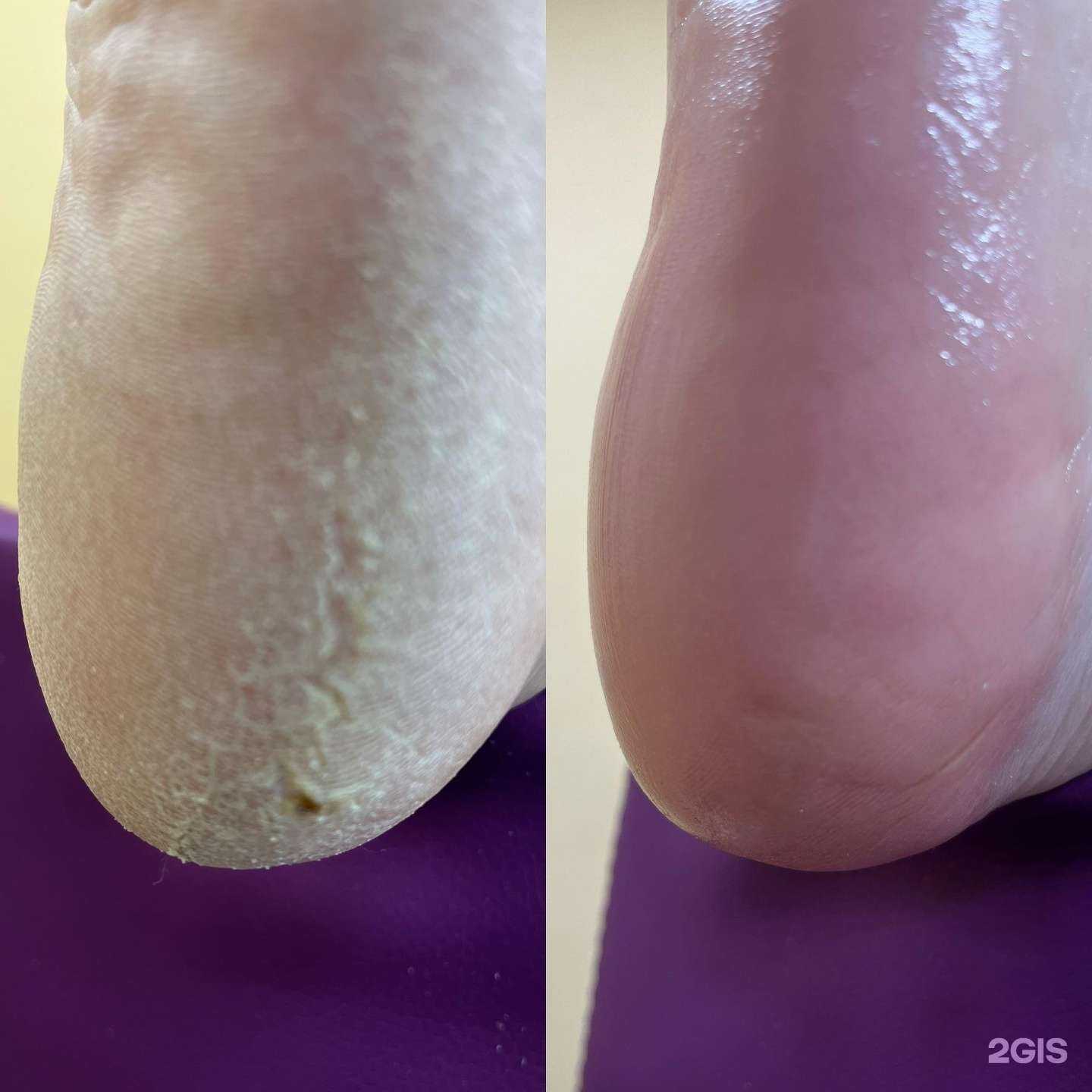 Отзывы на компанию Кабинет подологии и педикюра в г. Дудинка c фото