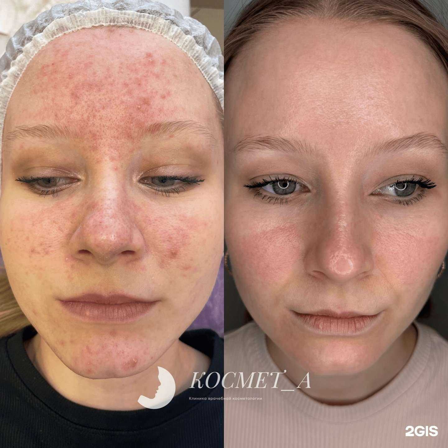 Отзывы на компанию Космет_А в Тюмени c фото