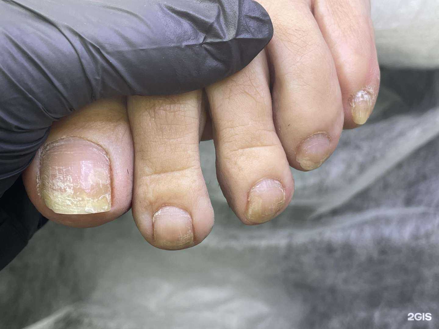 Отзывы на компанию Кабинет подологии ног и педикюра в Сургуте c фото