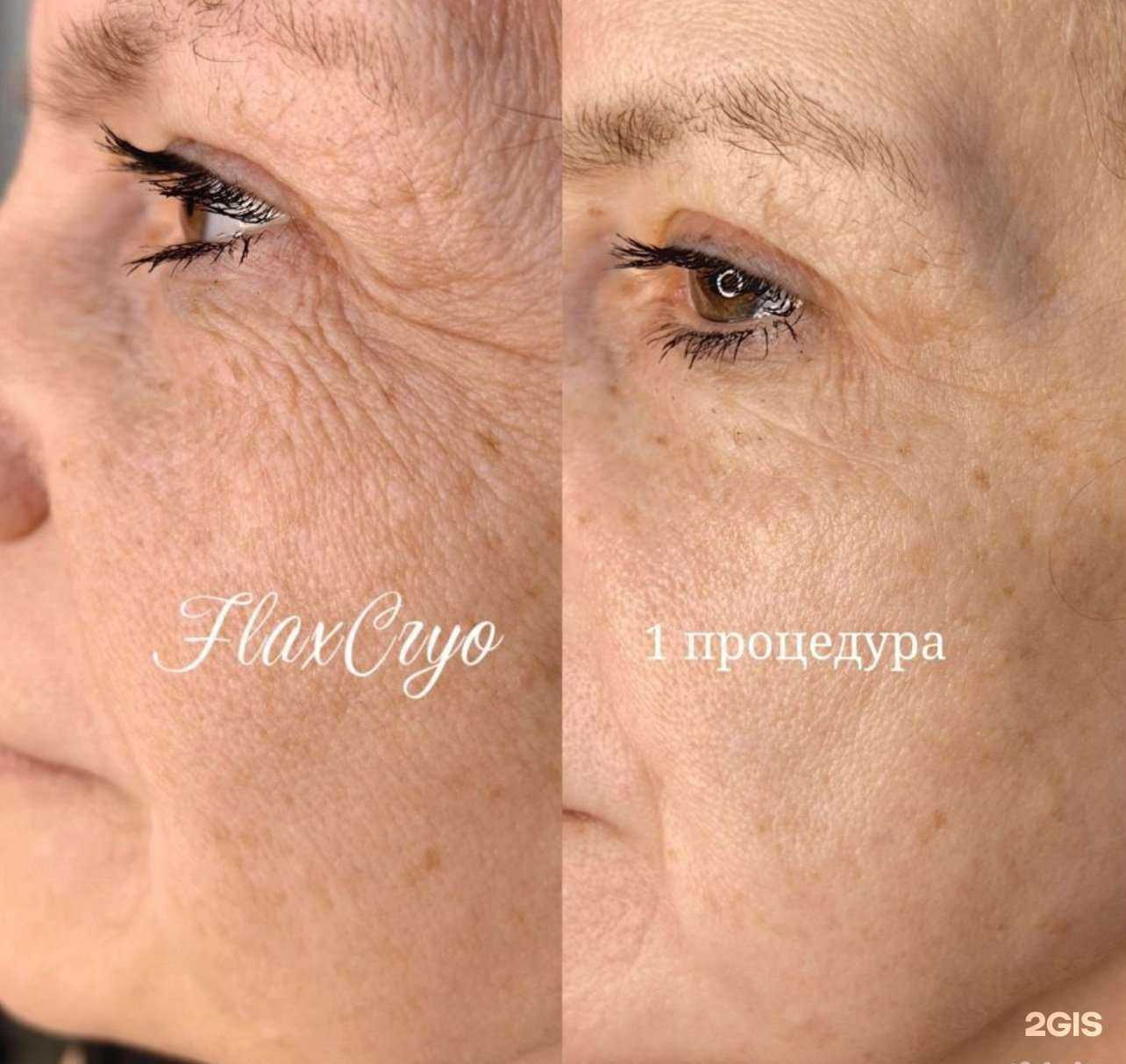 Отзывы на компанию FlaxTap в Краснодаре c фото