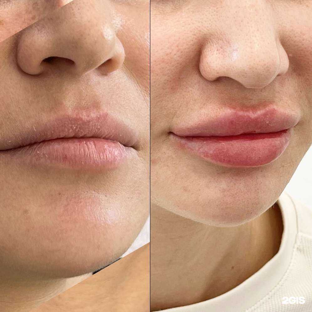 Отзывы на компанию Ваш косметолог в Екатеринбурге c фото