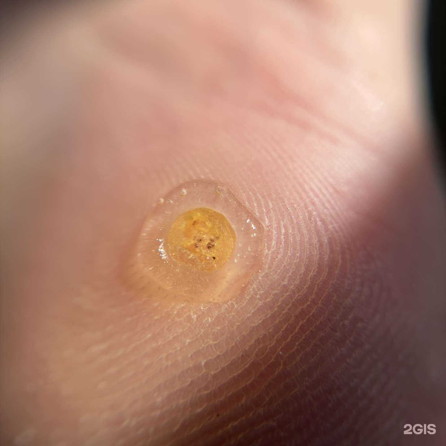 Отзывы на компанию Кабинет педикюра и подологии в г. Набережные Челны c фото