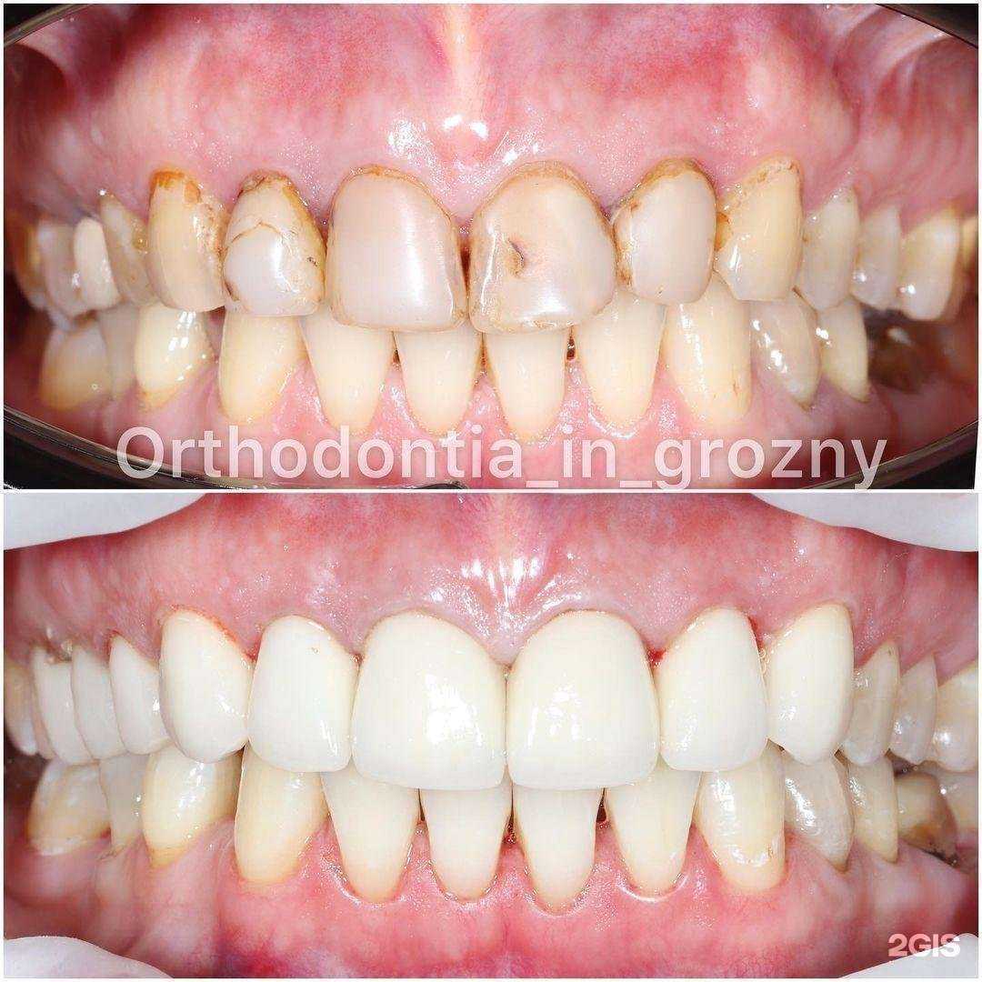 Отзывы на компанию Нью Смайлл в Грозном c фото