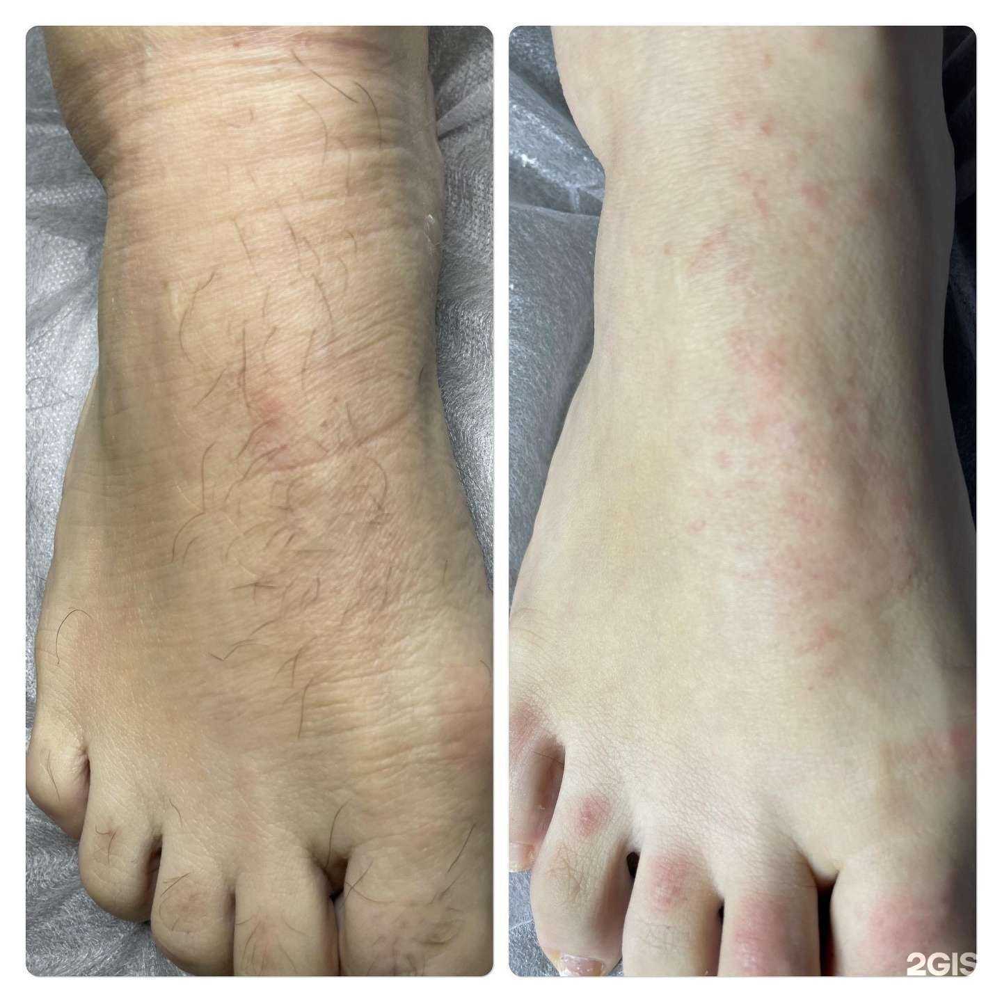 Отзывы на компанию Кабинет электроэпиляции в г. Краснодар c фото