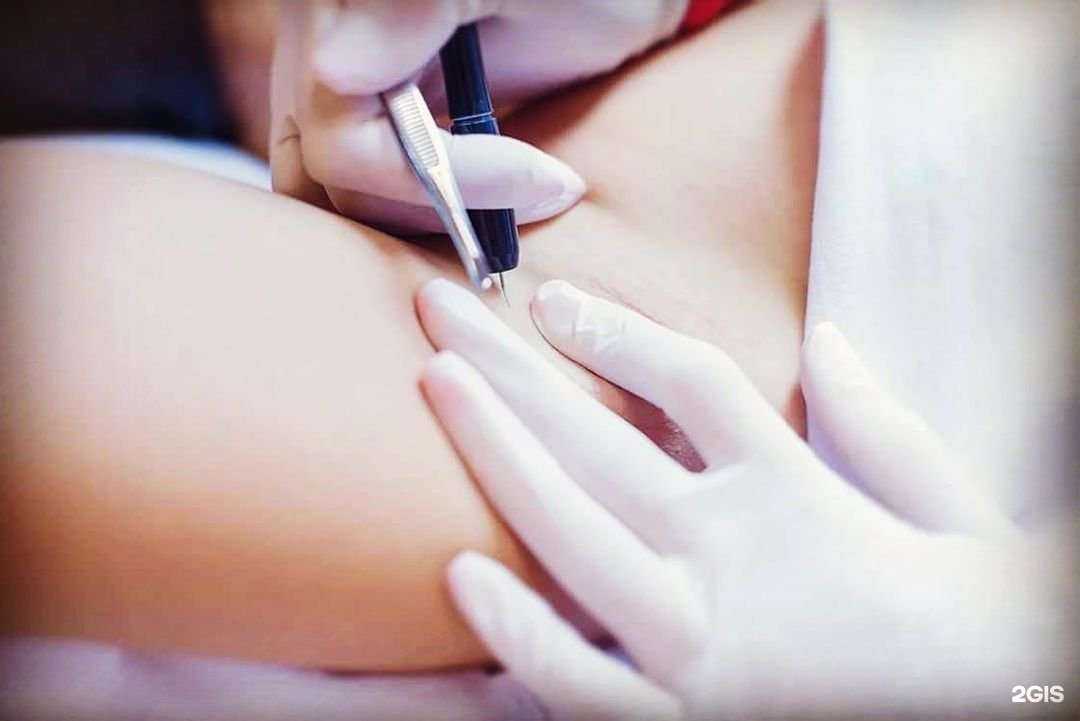 Отзывы на компанию LikeEpil в Орле c фото