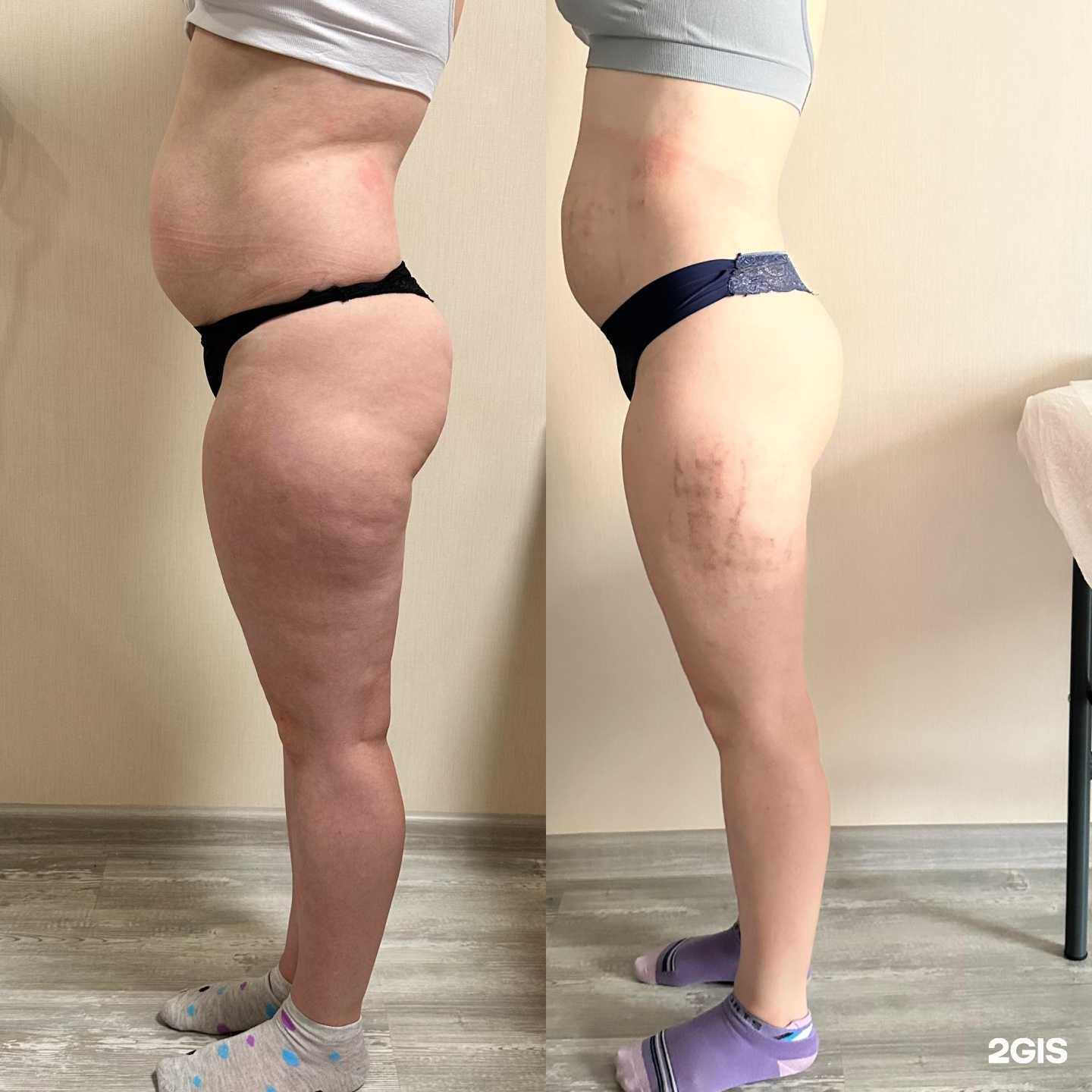 Отзывы на компанию Butterfly lpg в г. Тюмень c фото