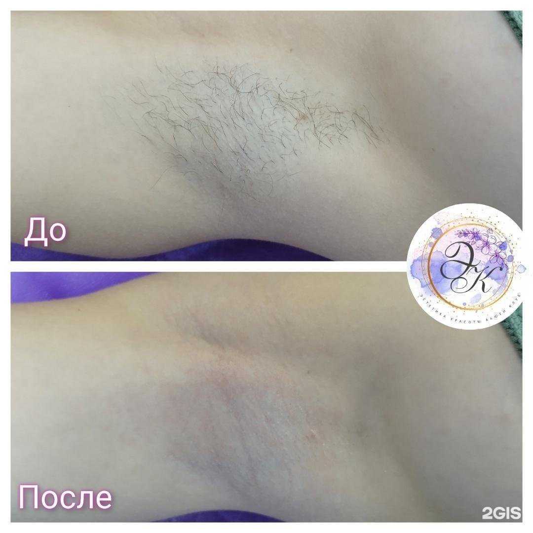 Отзывы на компанию Эстетика красоты в Тольятти c фото