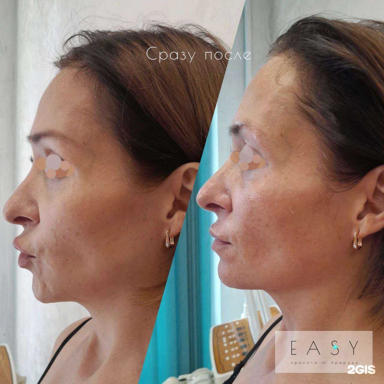 Отзывы на компанию Easy в Екатеринбурге c фото