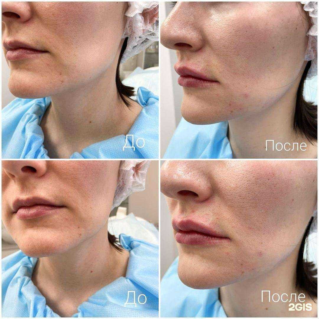 Отзывы на компанию Candela в г. Екатеринбург c фото