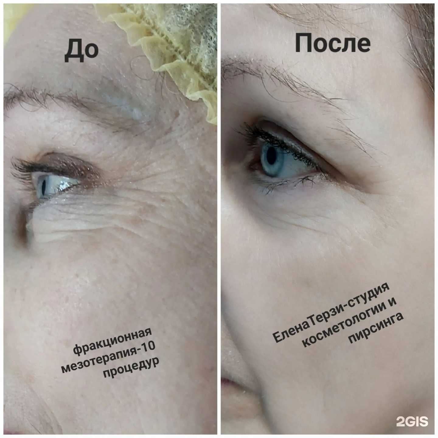 Отзывы на компанию Студия косметологии и пирсинга Елены Терзи в г. Пенза c фото