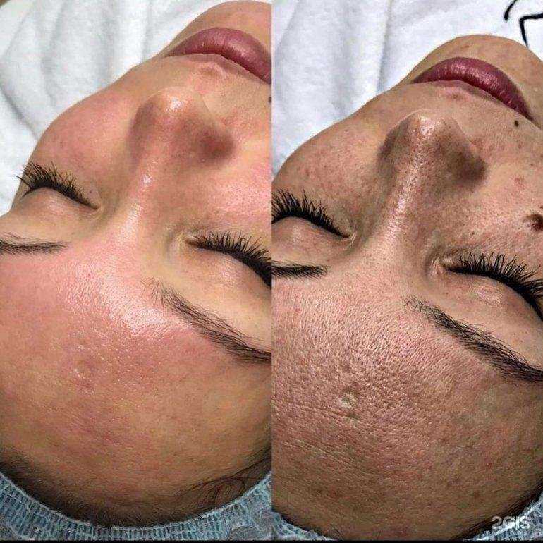 Отзывы на компанию Студия красоты и здоровья Ксении Черных в г. Пермь c фото