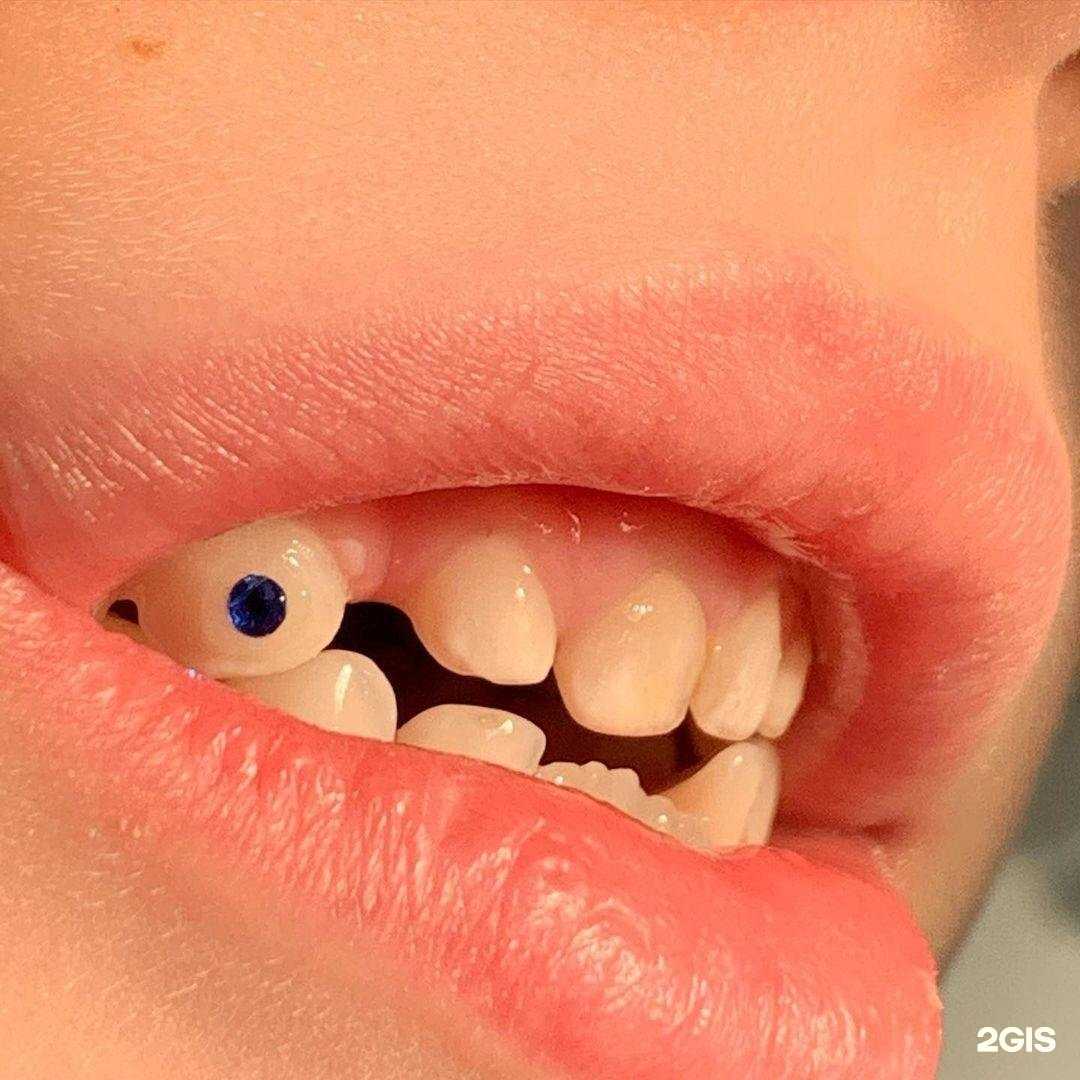 Отзывы на компанию Персона дентал в Крымске c фото