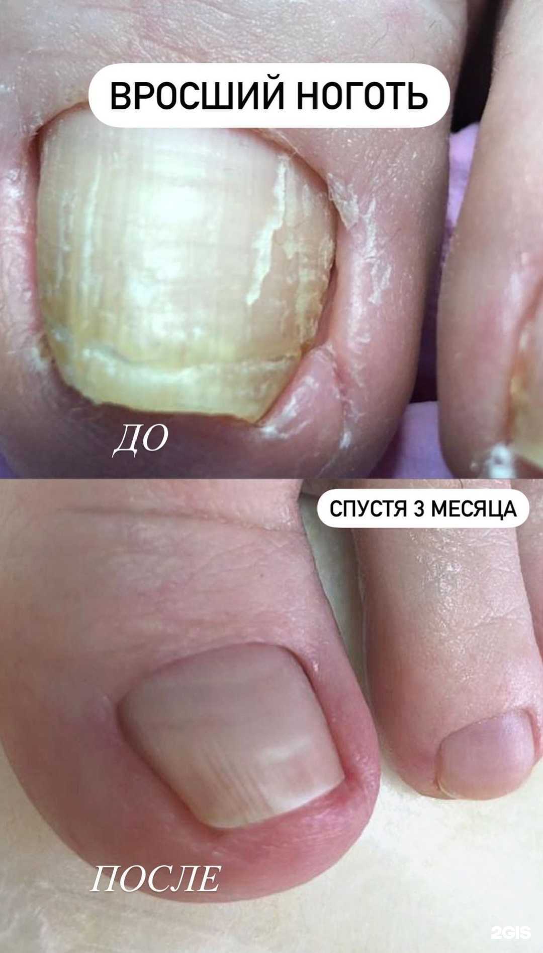 Отзывы на компанию Кабинет здоровых и красивых ногтей в Краснодаре c фото